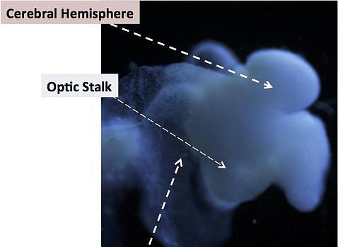 Crean una réplica 'casi' perfecta de un cerebro humano