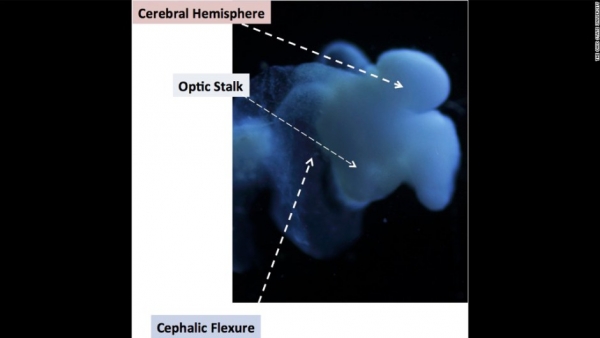 Científicos crean cerebro humano en estado embrionario