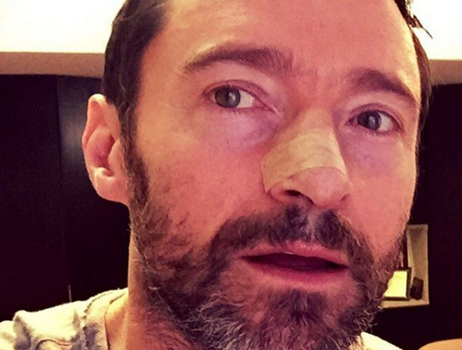 Operan a Hugh Jackman por quinta vez de cáncer de piel