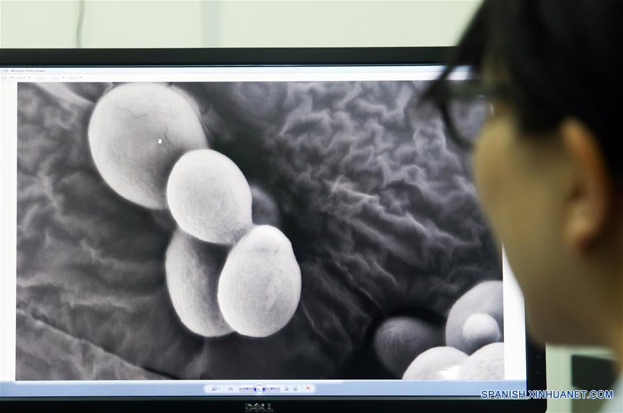 Imagen del 31 de julio de 2018 de una integrante del equipo del biólogo molecular, Qin Zhongjun, observando una sola cepa cromosómica de levadura a través del microscopio electrónico en el Centro de Excelencia en Ciencias Moleculares de Plantas, Instituto de Fisiología y Ecología Vegetal de Shanghai, de la Academia de Ciencias de China, en Shanghai, en el este de China. La levadura de cerveza, un tercio de cuyo genoma se dice que comparte ascendencia con el de un ser humano, tiene 16 cromosomas. Sin embargo, los científicos chinos han logrado colocar casi todo su material genético en uno solo sin afectar la mayoría de sus funciones, según un artículo publicado el jueves en el sitio web de Nature. Qin Zhongjun y su equipo utilizaron la edición de genoma CRISPR-Cas9 para crear una sola cepa cromosómica de levadura, indica el artículo. (Xinhua/Ding Ting)