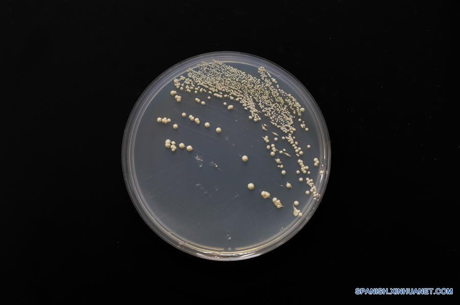 Imagen del 31 de julio de 2018 de una vista de una sola cepa cromosómica de levadura captada en el Centro de Excelencia en Ciencias Moleculares de Plantas, Instituto de Fisiología y Ecología Vegetal de Shanghai, de la Academia de Ciencias de China, en Shanghai, en el este de China. La levadura de cerveza, un tercio de cuyo genoma se dice que comparte ascendencia con el de un ser humano, tiene 16 cromosomas. Sin embargo, los científicos chinos han logrado colocar casi todo su material genético en uno solo sin afectar la mayoría de sus funciones, según un artículo publicado el jueves en el sitio web de Nature. Qin Zhongjun y su equipo utilizaron la edición de genoma CRISPR-Cas9 para crear una sola cepa cromosómica de levadura, indica el artículo. (Xinhua/Ding Ting)